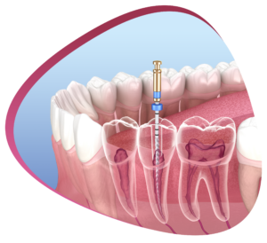 Endodonti